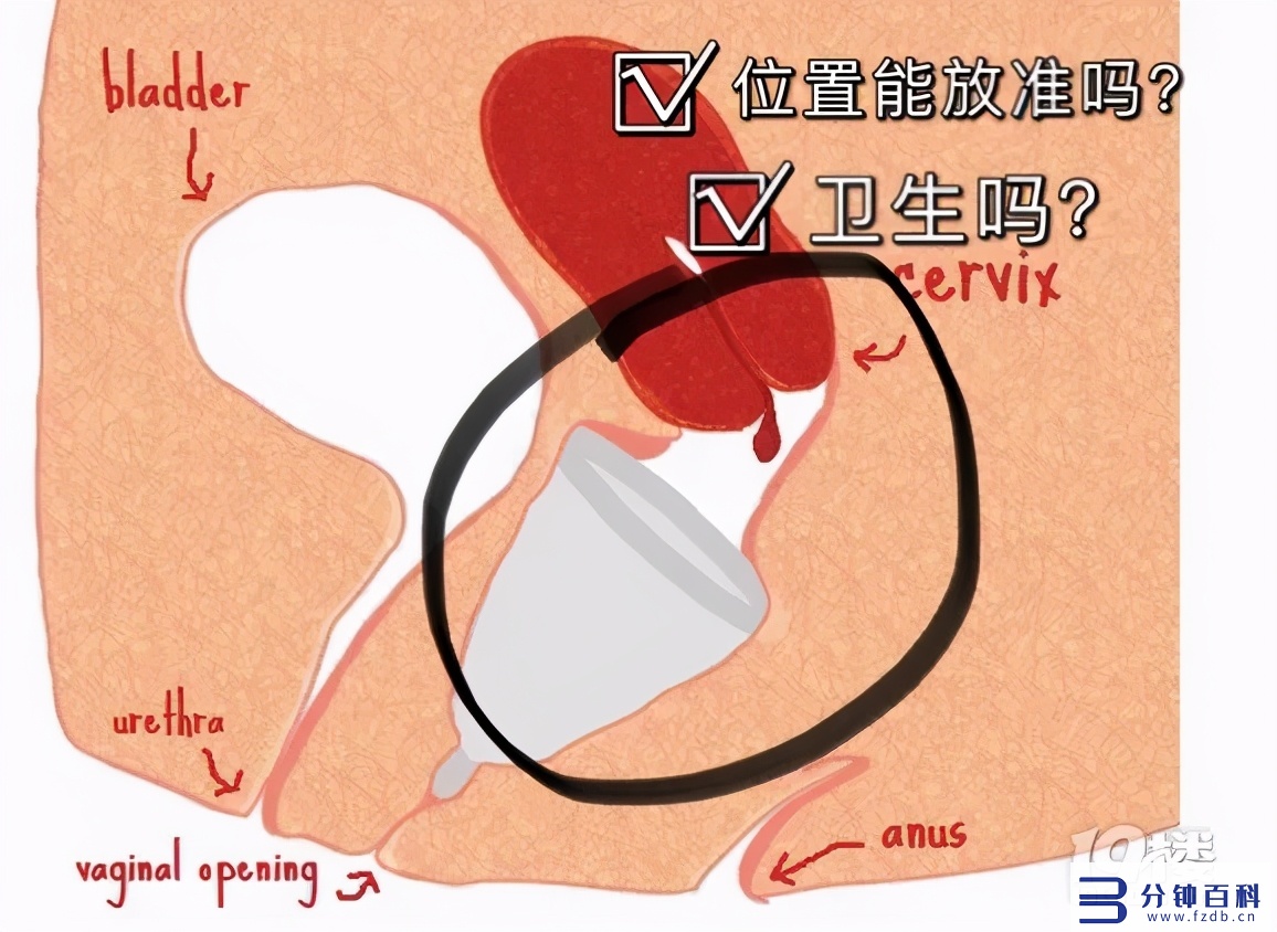 月经杯怎样塞进去图片（月经杯怎么塞视图）插图20